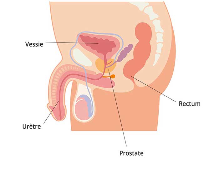 Prostate et confort urinaire